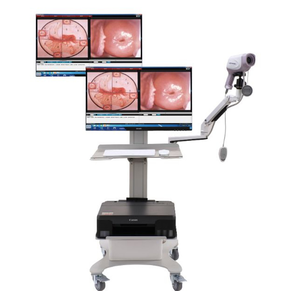 Colposcopio Digital HD 4K con  - Women'S Health & Wellness Center reseña y precio
